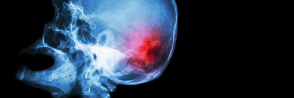 פגיעה עצבית בניתוח