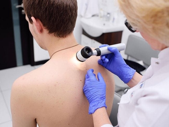 רשלנות רפואית סרטן העור