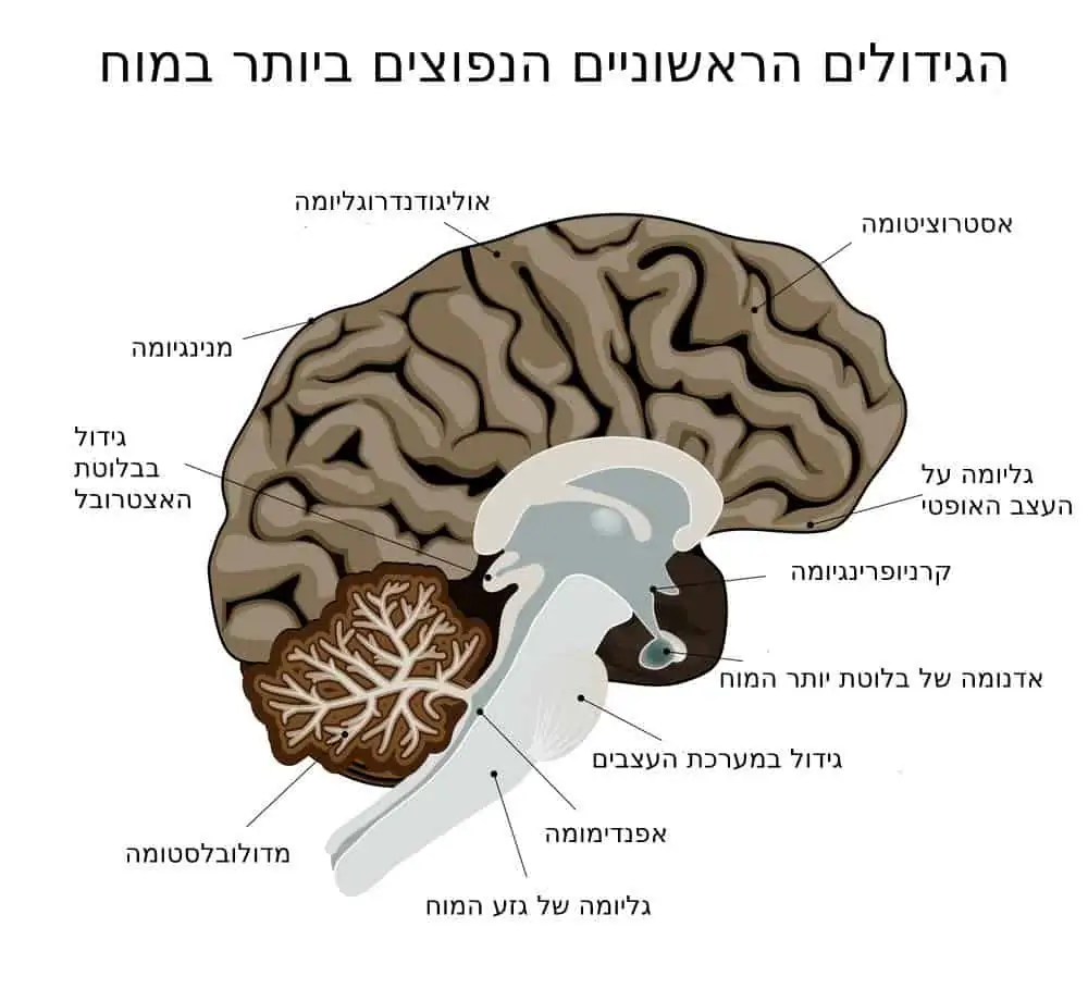 סוגים של גידולים במוח