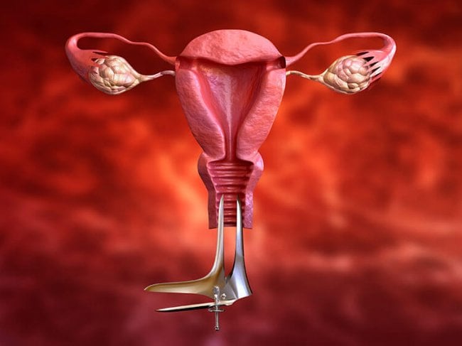 רשלנות רפואית סרטן צוואר הרחם