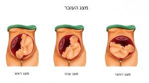 מצגי העובר