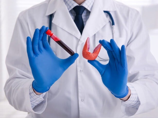 פעילות יתר של בלוטת התריס