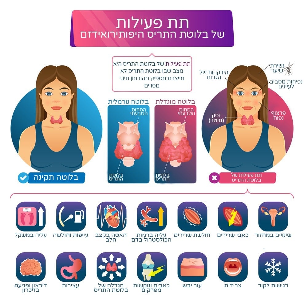 סימנים של תת פעילות בלוטת התריס