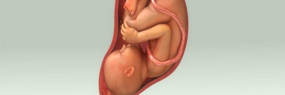 היפרדות שליה