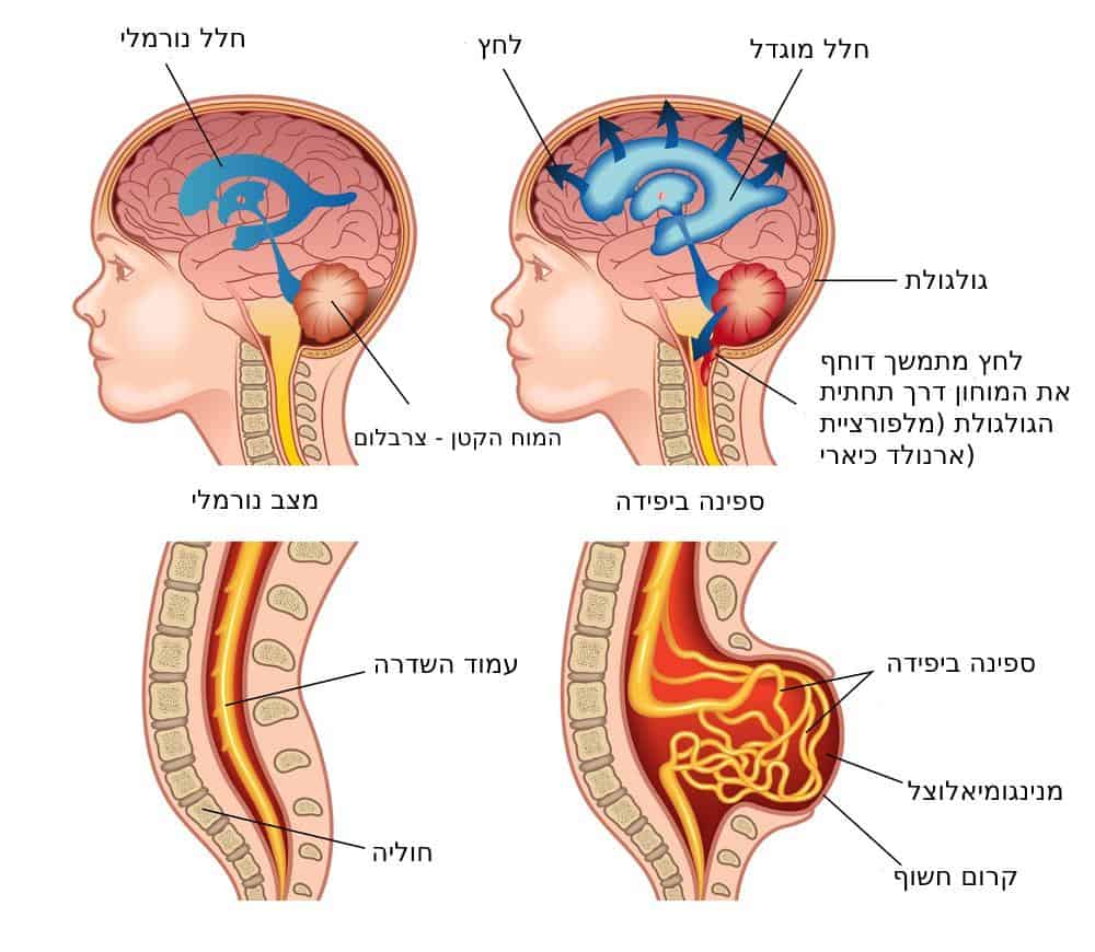 אינפוגרפיקה של ספינה ביפידה