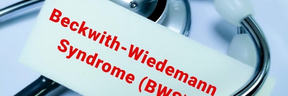 תסמונת בקווית׳ ווידמן תסמונת בקווית׳ ווידמן
