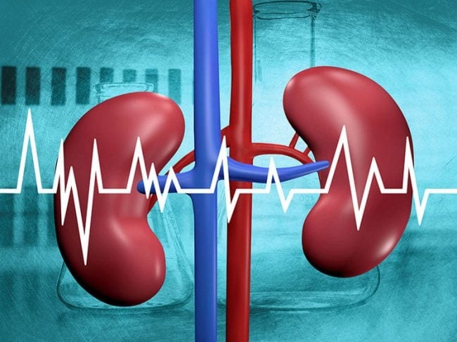 רשלנות רפואית בסרטן הכליה