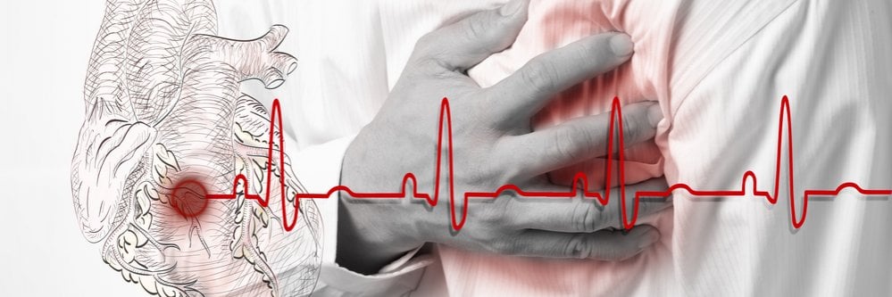 רשלנות רפואית באבחון התקף לב