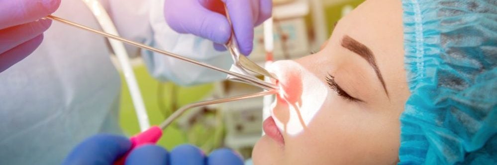 ניתוח סינוסים