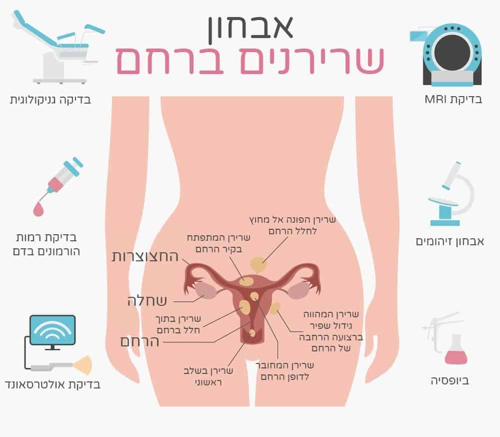 שרירנים ברחם